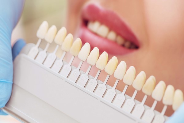 Veneers To Fix Tooth Imperfections